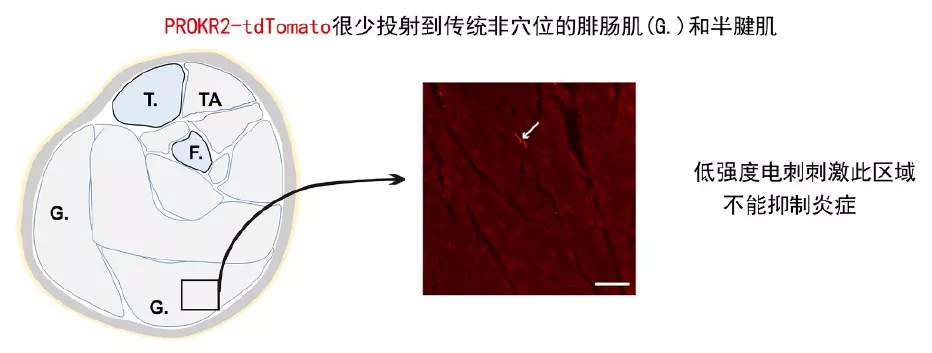 历史性突破！针灸研究登上Nature，哈佛华人学者为穴位存在提供现代神经解剖学基础